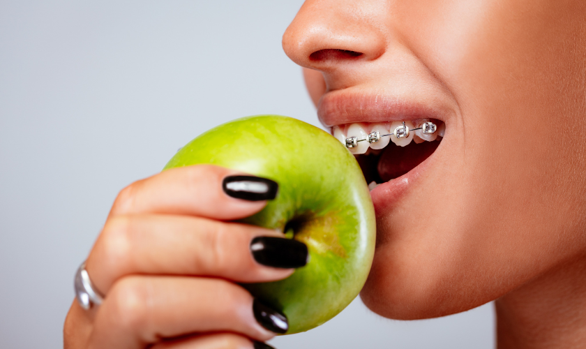 Foods to Avoid with Metal Braces