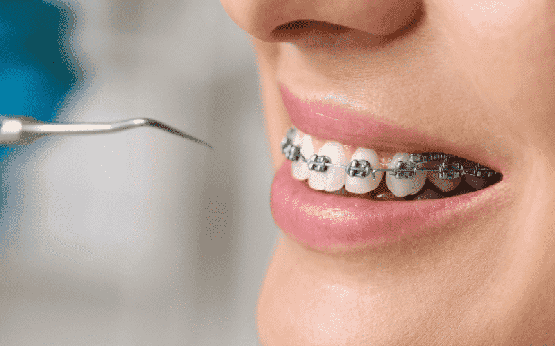 Orthodontic