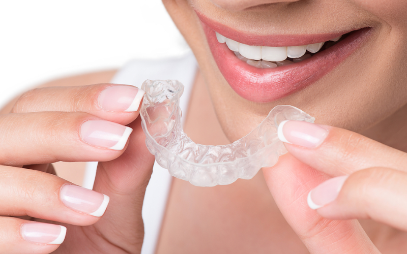 Orthodontic Treatment For Adults