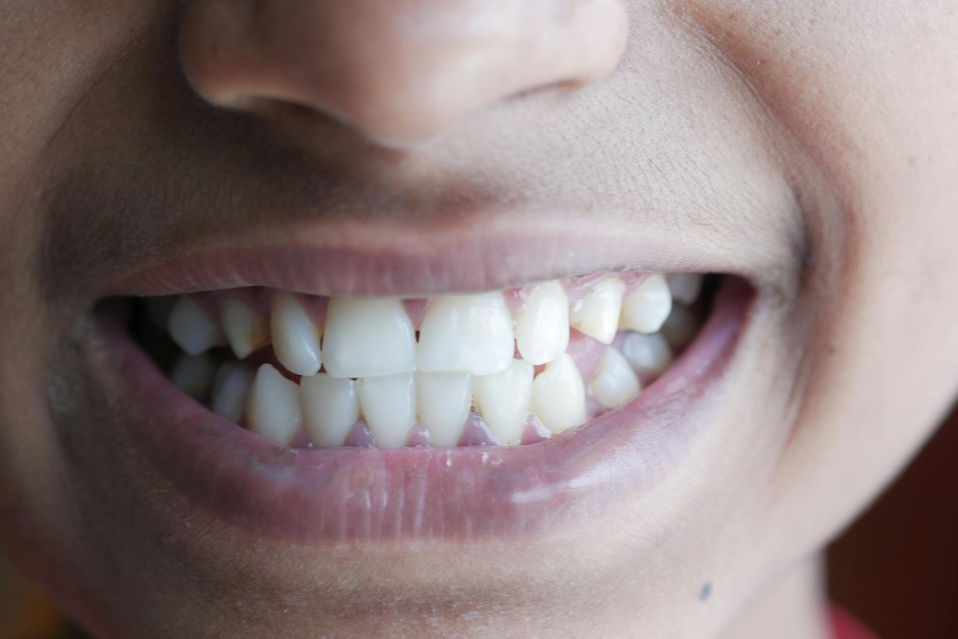 Orthodontics in Spokane Valley